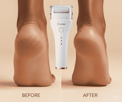 Râpe Électrique pour Pieds – Talons Doux & Sans Callosités