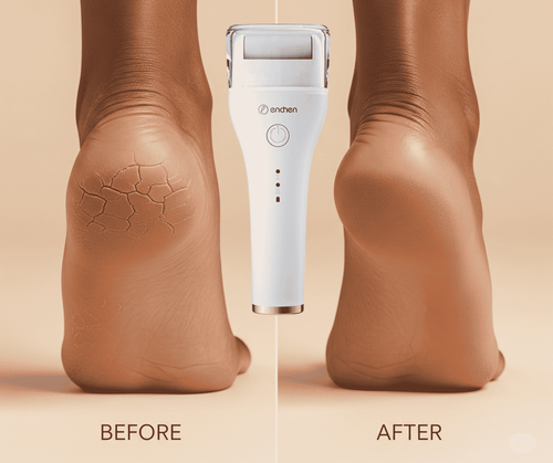 Râpe Électrique pour Pieds – Talons Doux & Sans Callosités